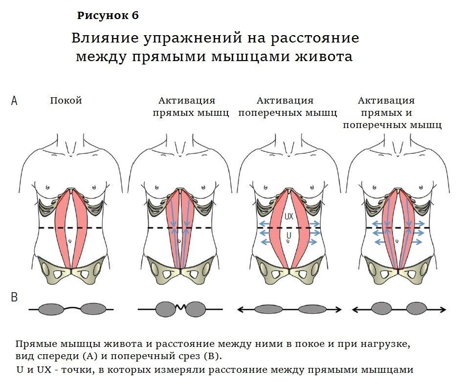 Упражнения для правильного расположения брюшных органов