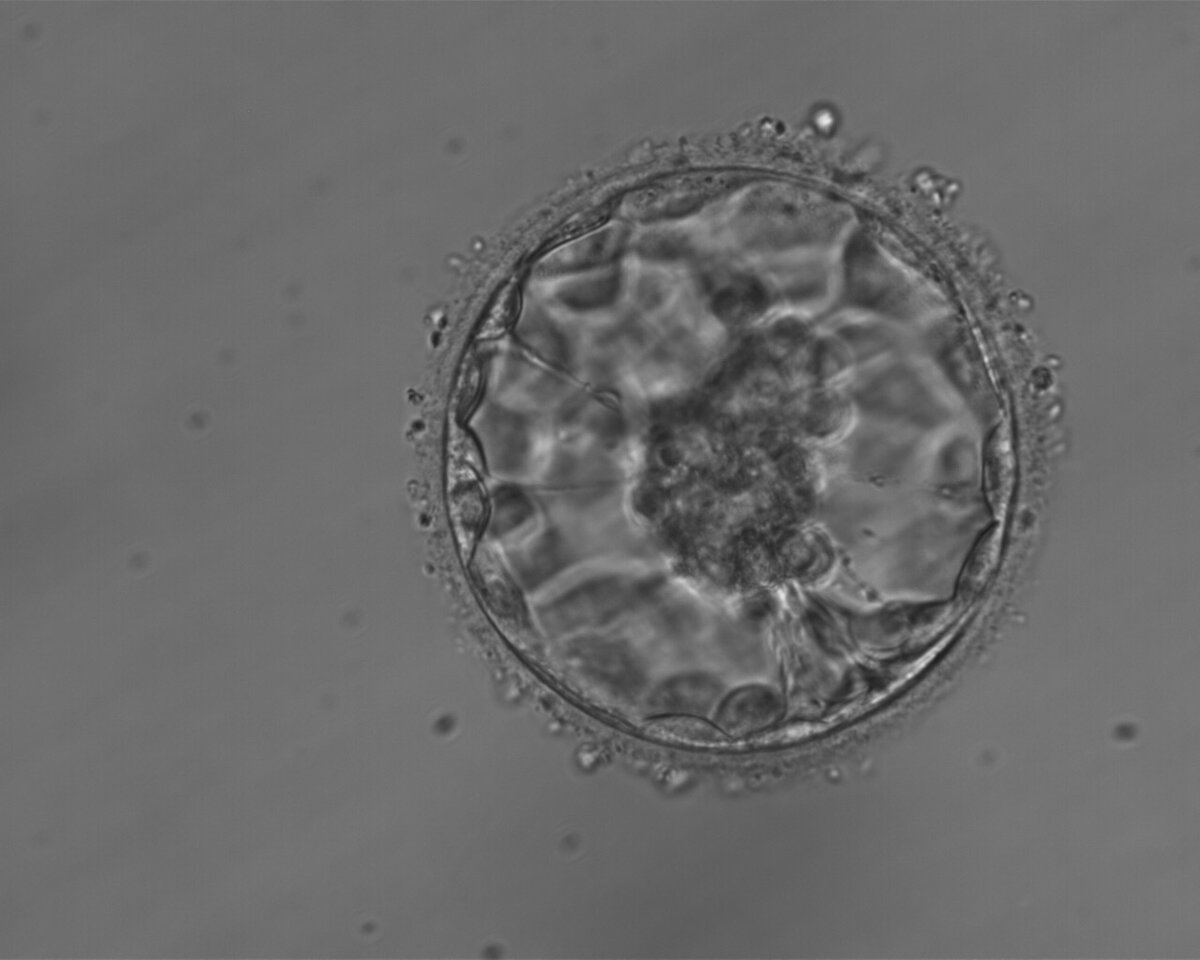 Так выглядит эмбрион в стадии бластоцисты  (5-й день развития)