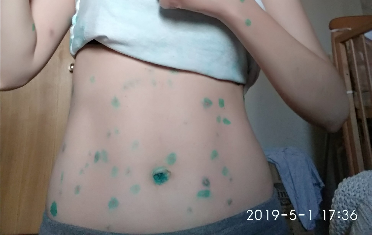                     (мой  живот) 