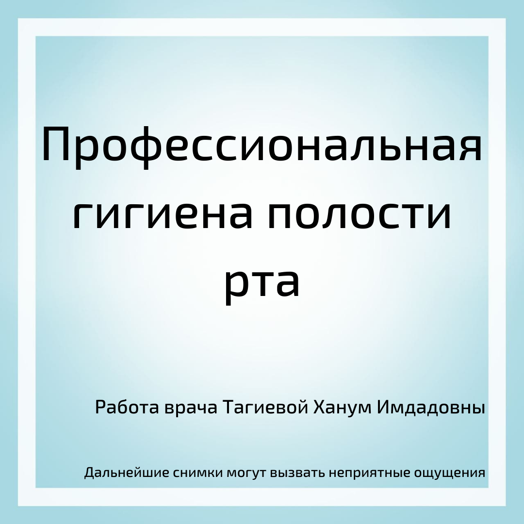 Профессиональная гигиена полости рта | Про зубы | Дзен