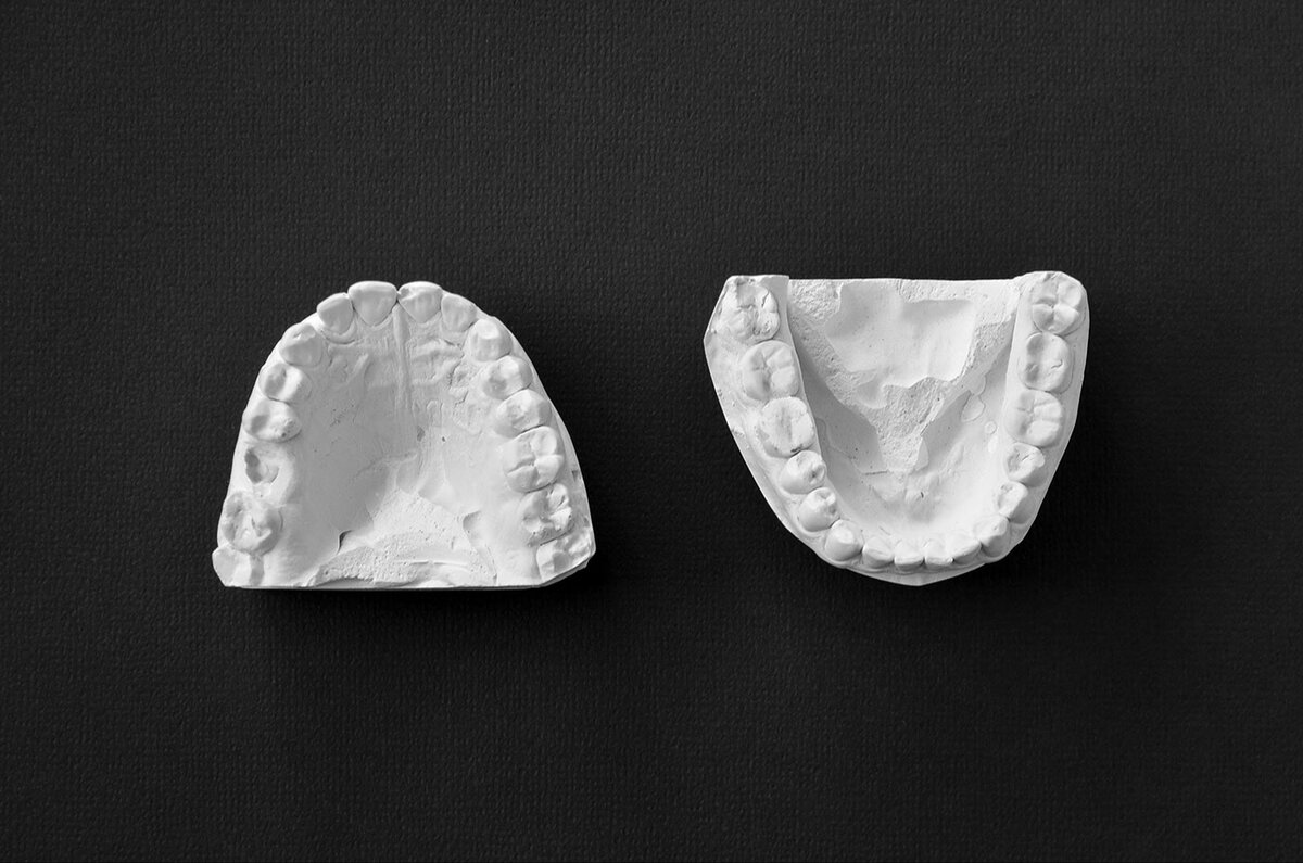    С заботой о здоровье: 5 важных вопросов стоматологу