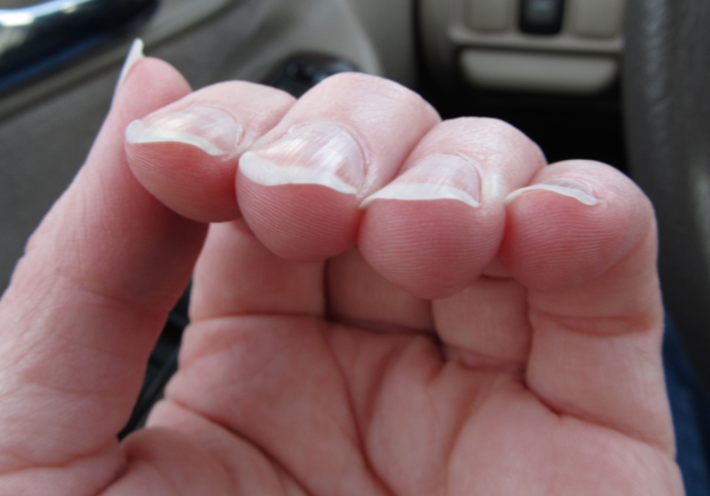 Гнущиеся ногти