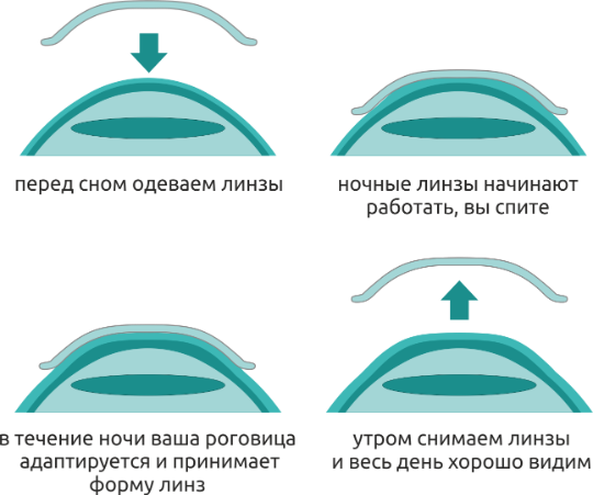 Можно ли спать в контактных линзах? Что будет если уснуть в линзах днем на час или два?