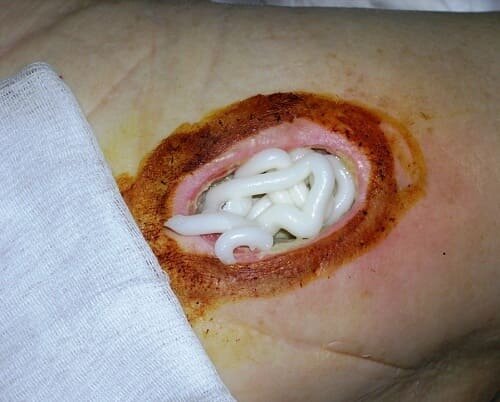 
На фото можно увидеть, как нужно наносить мазь на очищенную рану.