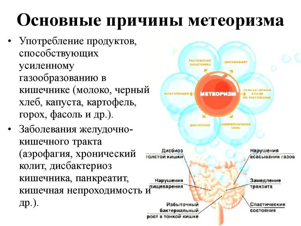 От чего бывает вздутие живота? Причины и виды метеоризма | ИзучаюМир | Дзен