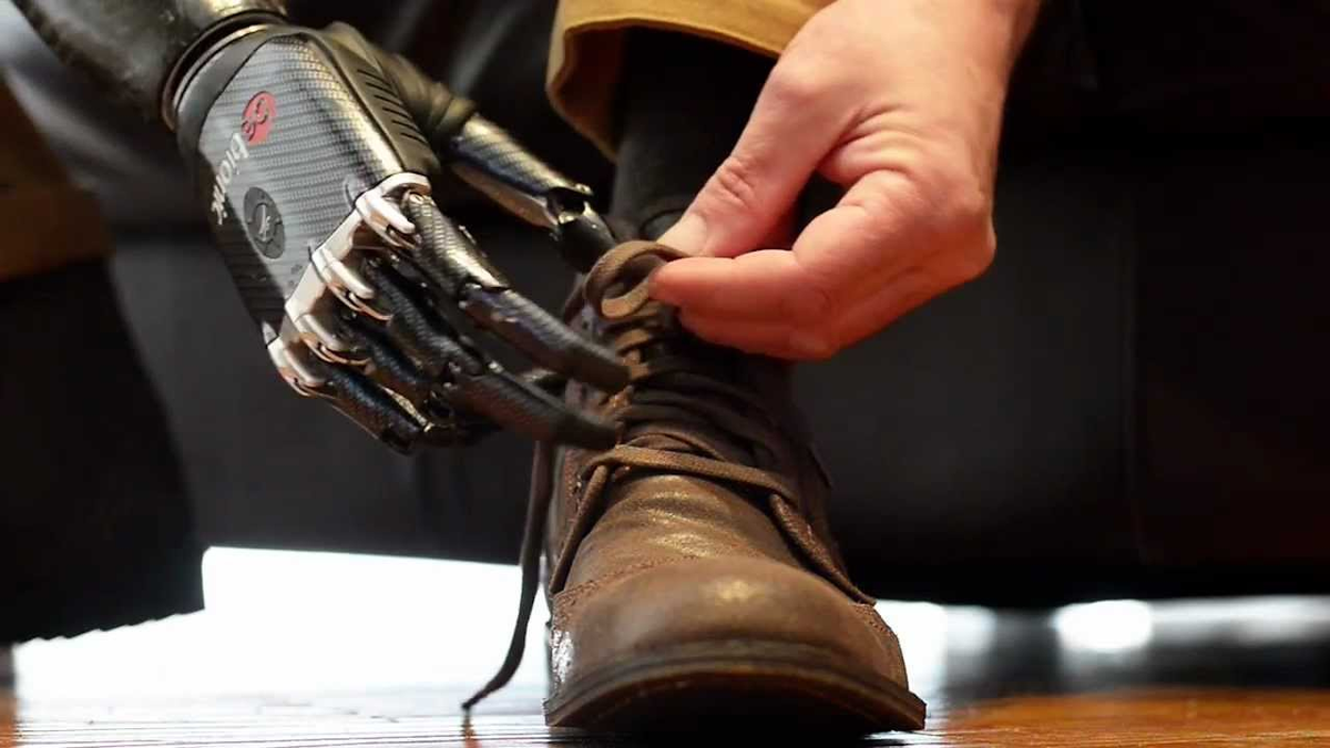 Бионический протез ноги. Bebionic протезы. Найджел Экланд протез. Найджел Экланд бионическая рука. Бионические протезы в СССР