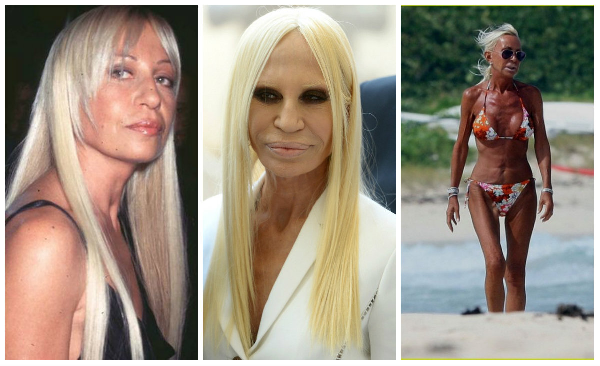 Донателла Версаче - жертва пластики