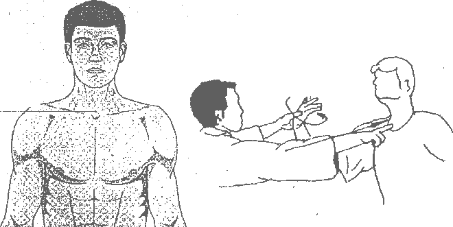 Схема воздействия на болевую точку.