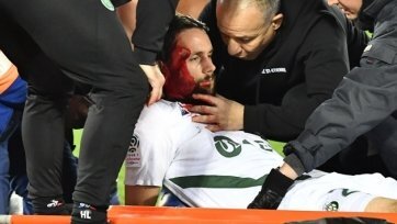 Фото: lequipe.frВ матче 16-го тура французской Лиги 1 против «Бордо» голкипер «Сент-Этьена» Стефан Руффье коленом снес 29-летнего серба, который сразу же упал, истекал кровью и потерял сознание.
