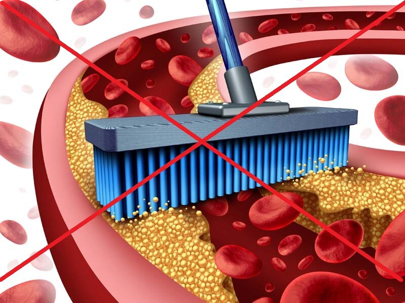 атеросклероз очищение сосудов. народный метод очистки сосудов. для очистки сосудов рецепт. очищение сосудов народными средствами. очистка капилляры.