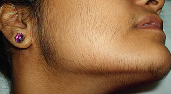 фото: https://www.skalpil.ru