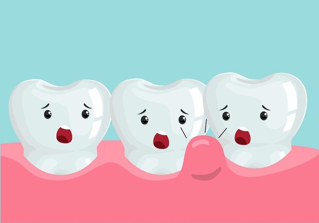 Источник https://www.instagram.com/dental.fantasy/