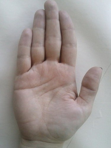 Правый пальчик. Деформация мизинца на руке. Искривление среднего пальца на руке хиромантия. Деформация указательного пальца.