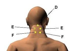 Что такое акупрессура и как она действует?