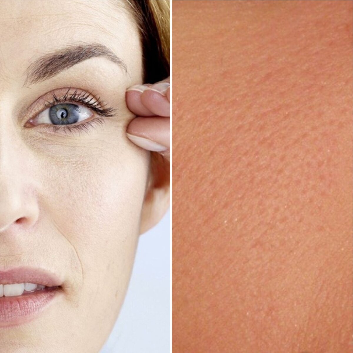 Признаки сухой кожи