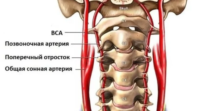 Компрессия левой позвоночной артерии. Анатомия позвоночной артерии в шейном отделе. Спазм левой позвоночной артерии. Спазм позвоночной артерии психосоматика. Зарядки при позвоночной артерии.