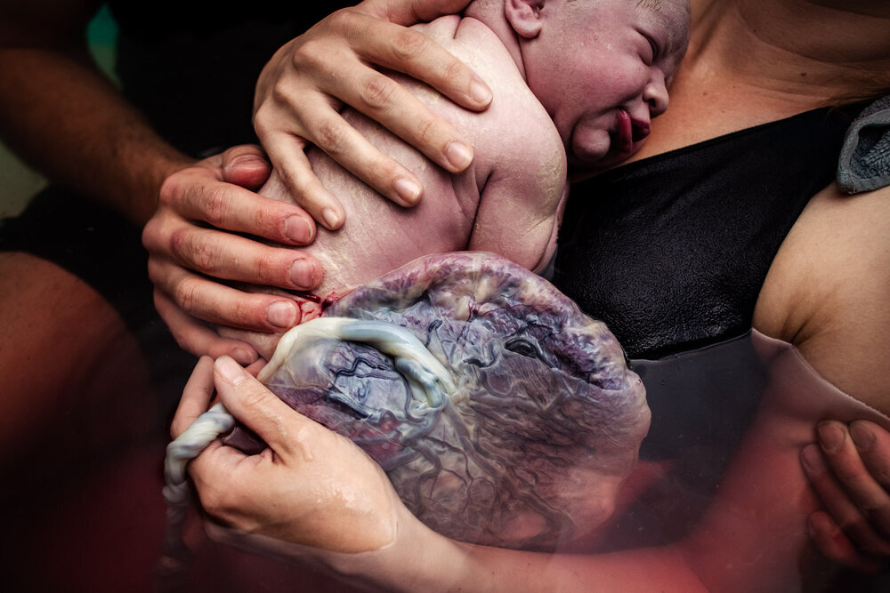 Стремительные роды. Фото birthbecomesyou.com