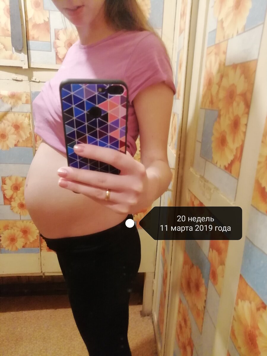                  Беременность примерно 20 недель 