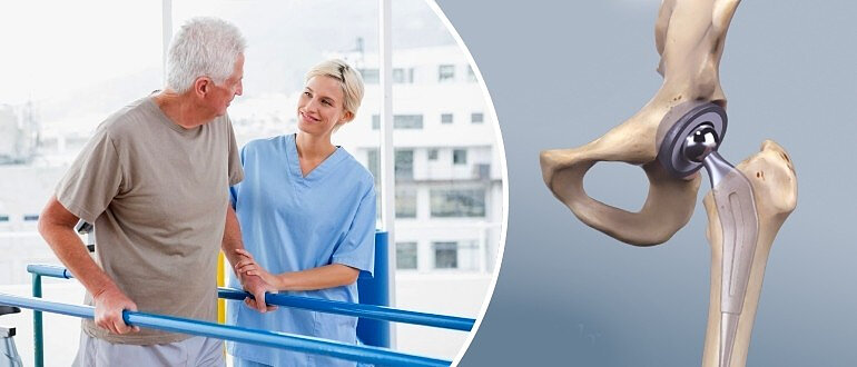 Подготовка к операции по эндопротезированию тазобедренного сустава может потребовать времени