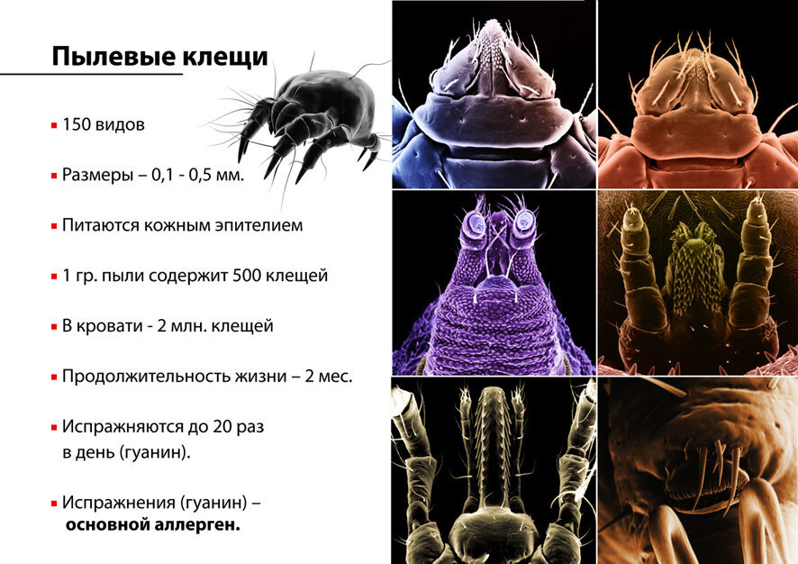 Как выглядит аллергия на пылевого клеща