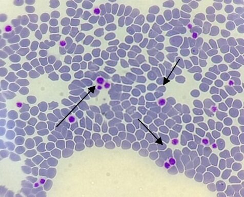 Фото 1. Тромбоциты кошки 1. Иммерсионная микроскопия объектив *100. Черные стрелки указывают на тромбоциты обычных размеров. Макротромбоцитов в препарате не обнаружено. 