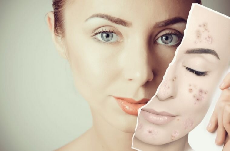 С просторов интернета