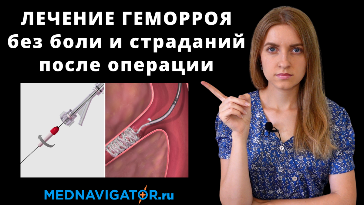 Геморрой - лечение методом эмболизации геморроидальных узлов без боли ...