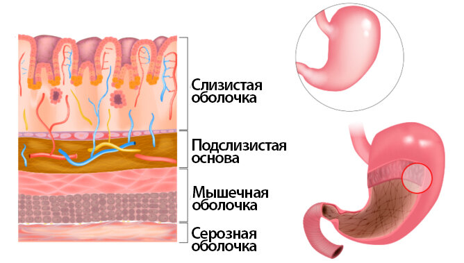 Локализация слизистой оболочки