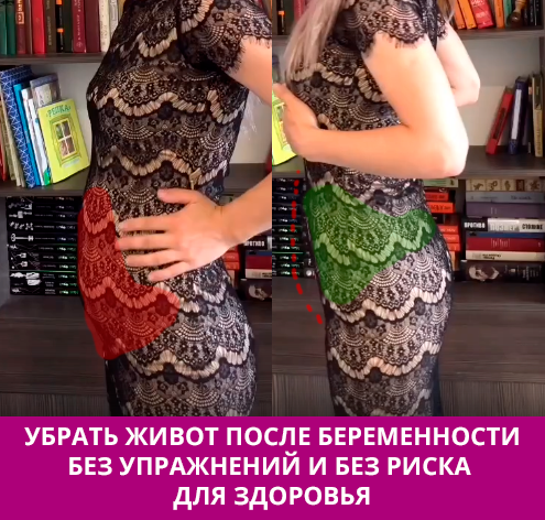 Как быстро убрать живот после родов?