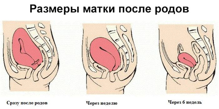 Послеродовая субинволюция матки