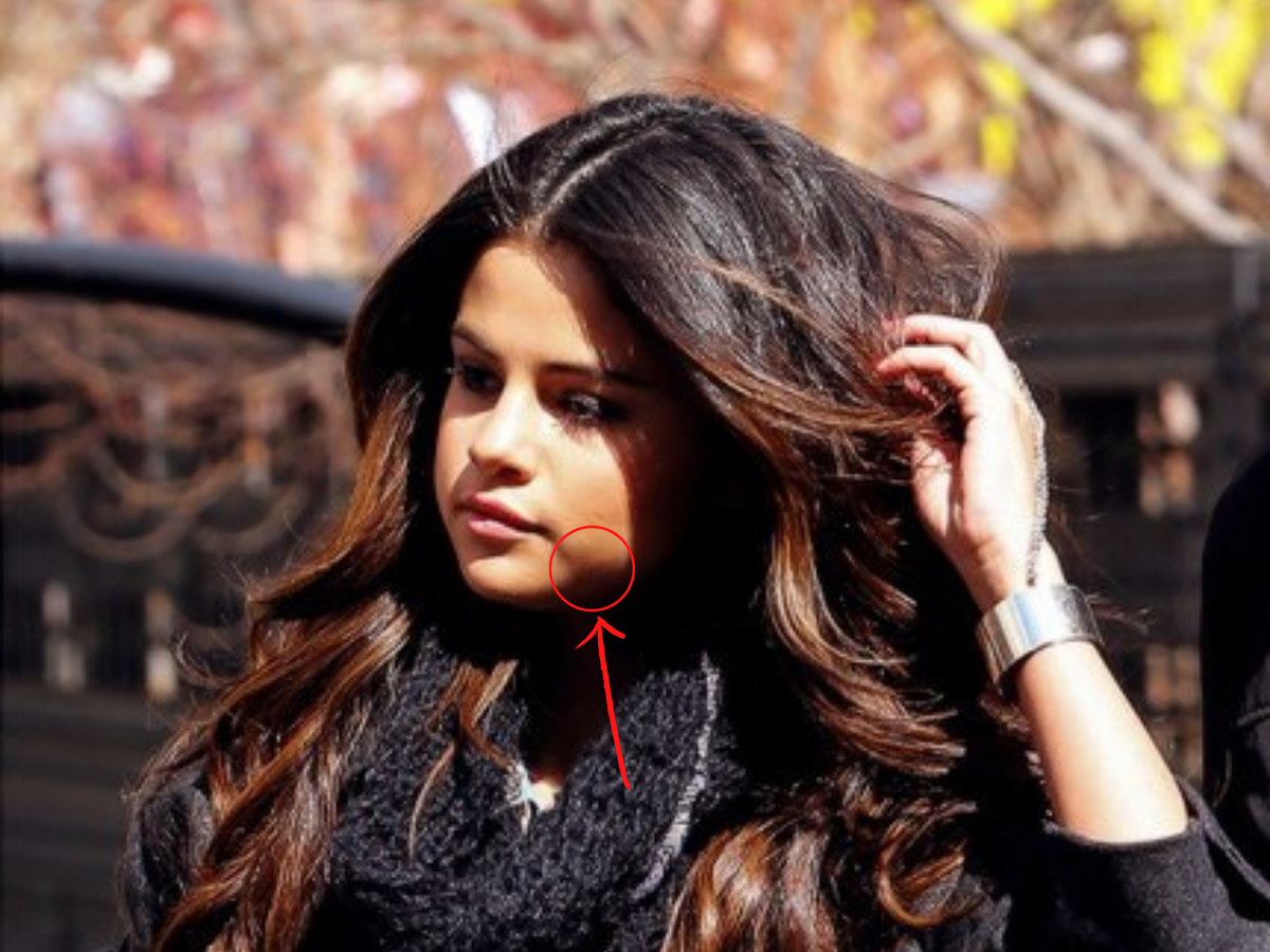 Селена Гомес, которой только 29 лет, но на ее все еще по-детски округлом лице уже наметились предательские бульдожьи щечки.