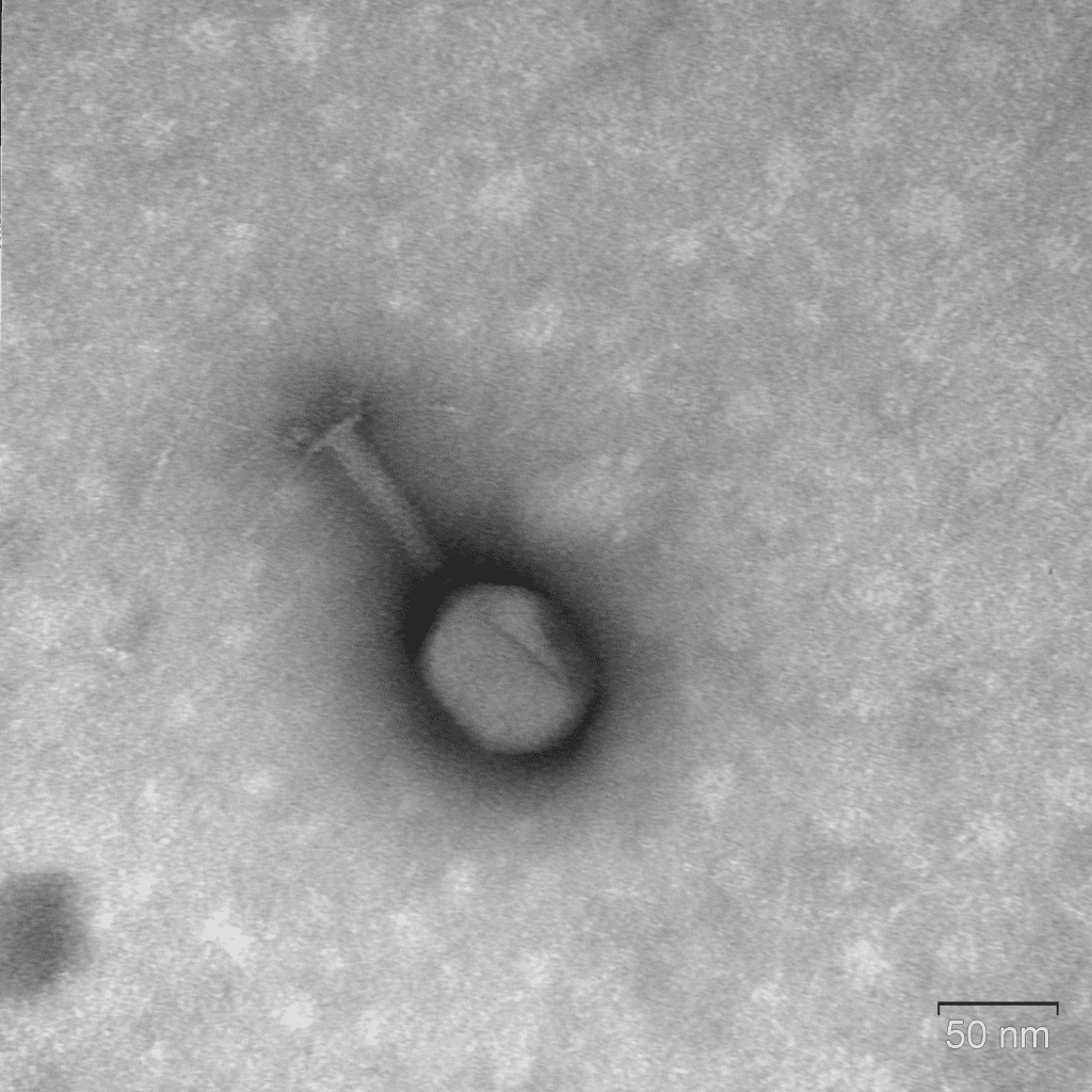    Фотография бактериофага, сделанная с помощью с электронного микроскопа / ©Пресс-служба “Нацимбио”​