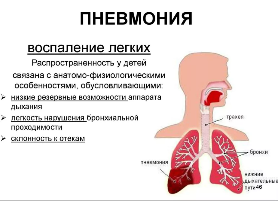 Пневмония у детей до года