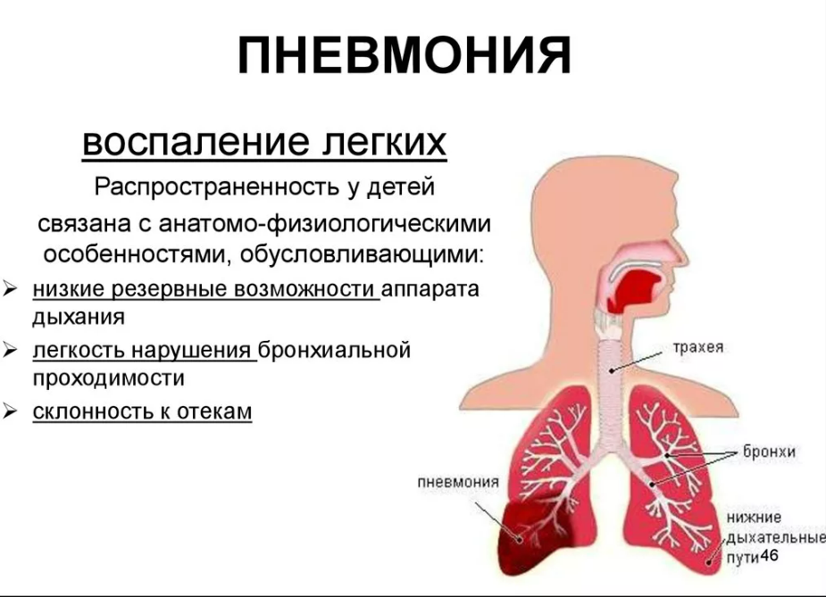 Чем грозит пневмония. Легочные проявления пневмонии.