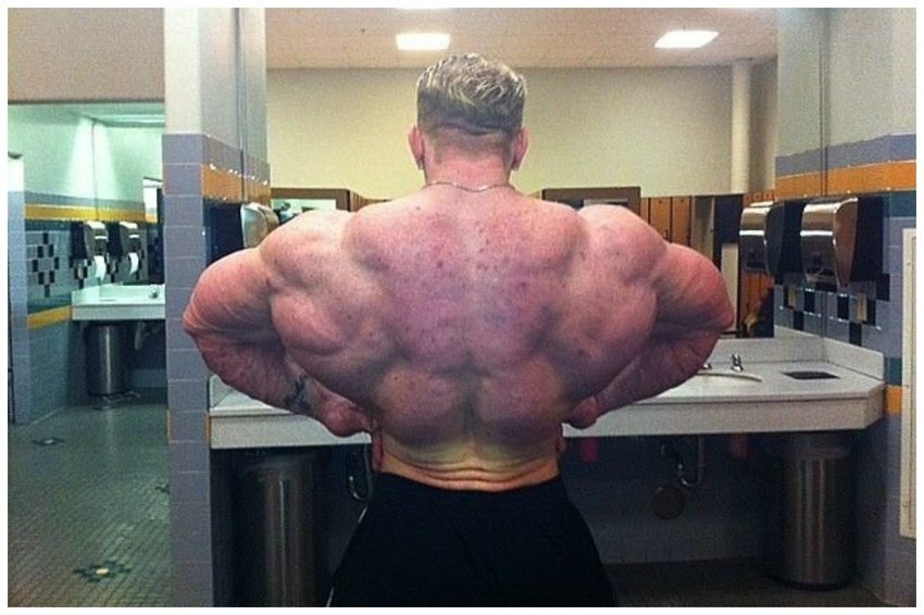 Прыщи на спине бодибилдера 