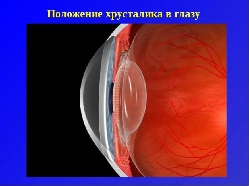 Как выглядит хрусталик глаза Хрусталик - естественная линза глаза Азбука офтальмологии Дзен