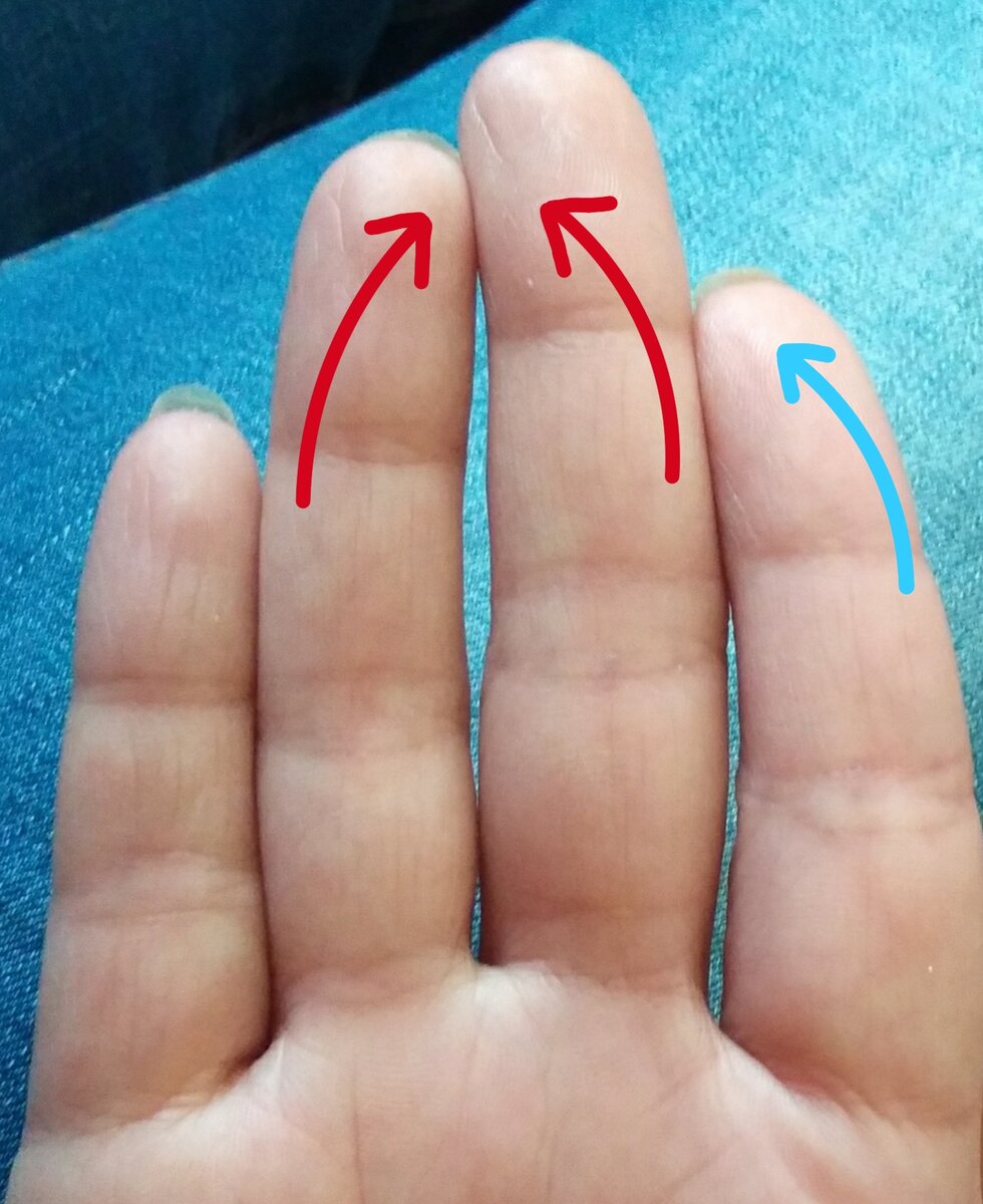 Наклон пальцев на руке 