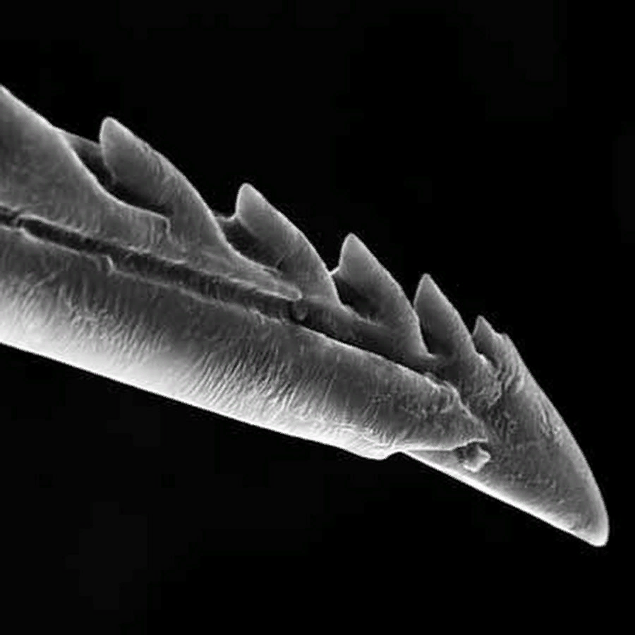 Жало пчелы под микроскопом (фото из Интернета)