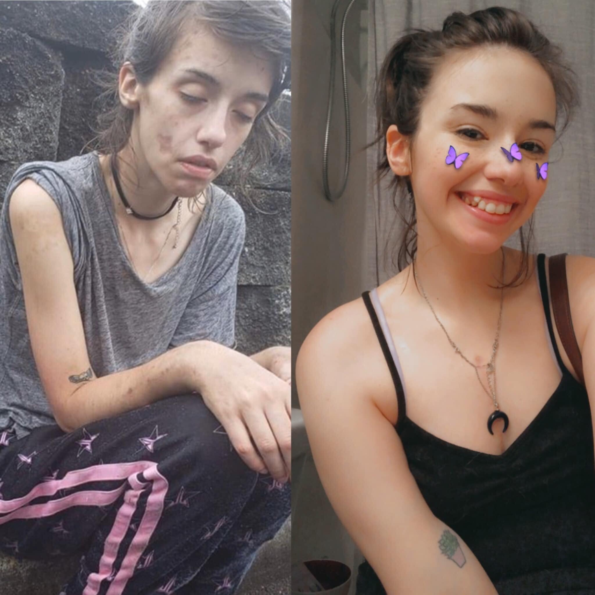 Люди изменившие внешность. Подростки до и после.