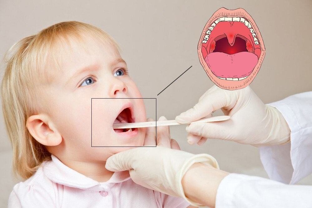 Почему во сне текут слюни | Статья DentalOpera