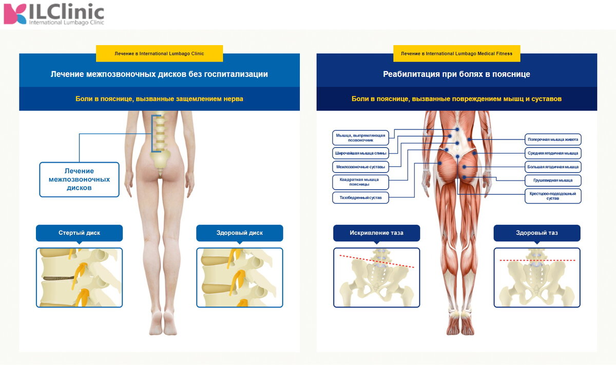 Комплексный подход в лечении - сотрудничество International Lumbago Clinic и Центра Медицинского Фитнеса
