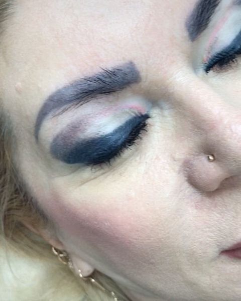 Сводить этот ужас дорого и больно!