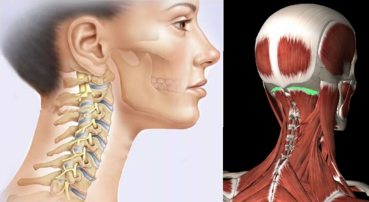 Как укрепить шею, чтобы не болела? Почему нельзя делать упражнения на все  мышцы подряд | Причины Здоровья | Дзен
