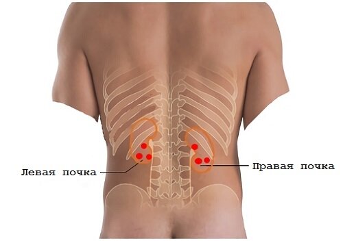 Болит поясница. Почему может ломить поясницу?