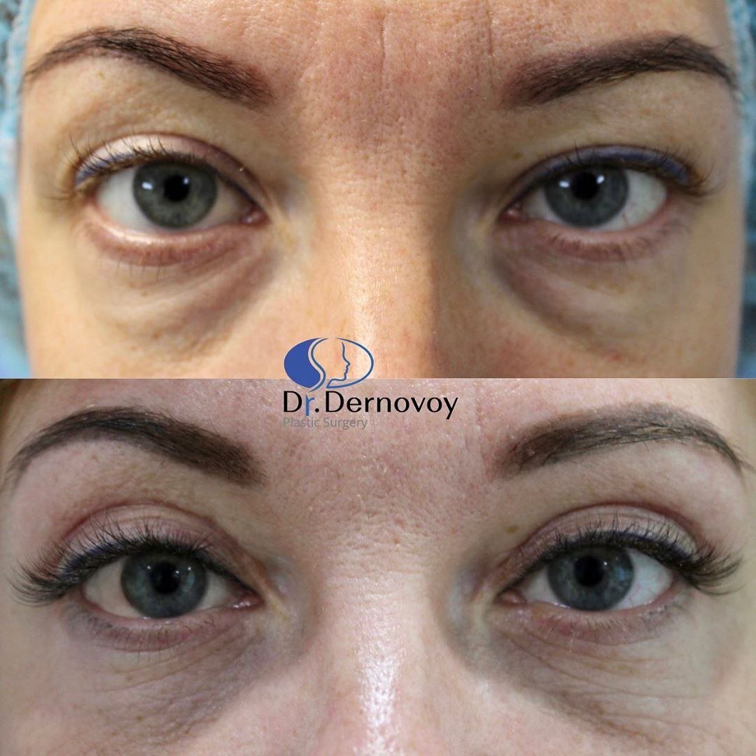 Результат одной из операций С.С. Дернового