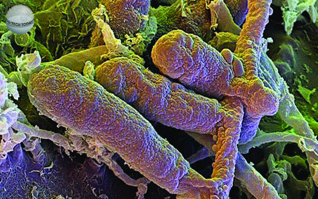 Грибковая инфекция