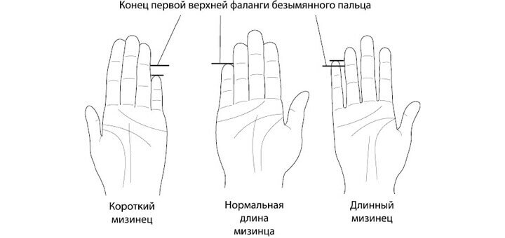 На левой руке немеет мизинец и безымянный. Значение ношения колец на пальцах рук у женщин. Мизинец в Китае что означает. Что значит кольцо на мизинце. Что означает мизинец средний и большой палец в виде короны.