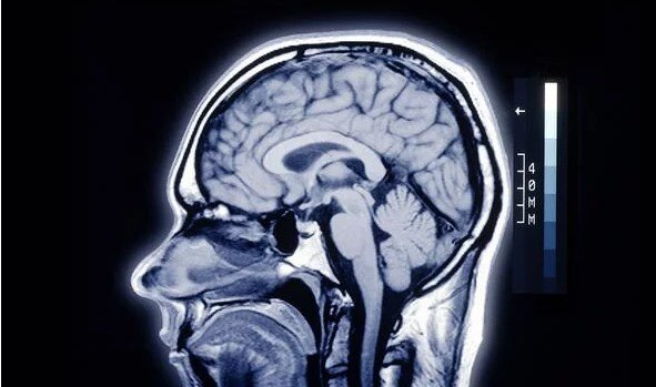 Что происходит после смерти: высвобождает ли мозг психоактивные химические вещества?