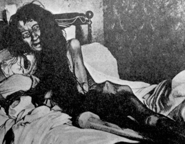 Это фото выглядит как постер к фильму ужасов об изгнании дьявола, но, к несчастью, фото абсолютно реально, и история за ним ужасает куда больше любого фильма.
В конце девятнадцатого века в городке Пуатье во Франции проживала семья Монье – семья принадлежала к самой верхушке среднего класса, ее уважали в округе, а Комитет добрых дел даже присудил ей награду, которой удостаивались только самые почетные граждане. Когда исчезла 25-летняя Бланш Монье, это не вызвало совершенно никаких подозрений. До тех пор, пока 25 лет спустя Генеральный прокурор Парижа не получил анонимное письмо, в котором сообщалось, что в доме мадам Монье держат взаперти женщину, которая живет впроголодь и спит на матрасе, покрытом вшами и ее собственными экскрементами.
Когда полиция нашла Бланш запертой в темной комнате, ее вес едва составлял 24 килограмма, она не видела солнца уже четверть века. Мать и брат Бланш спрятали ее от всего света, чтобы не допустить брака с человеком, чье положение они посчитали ниже социального положения их семьи. Хотя Бланш и смогла позже набрать немного веса, ей так и не удалось восстановить психическое здоровье. Девушка умерла в психиатрической клинике спустя тринадцать лет после того, как ей посчастливилось вырваться из своей клетки.