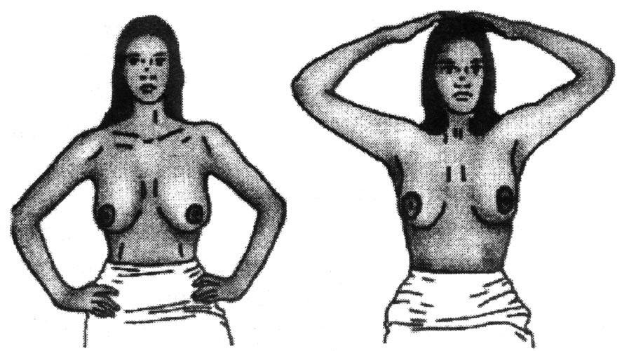                                 Рис 1                                                              Рис 2